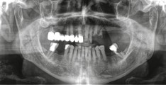 CLINICAL CASES