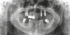 CLINICAL CASES