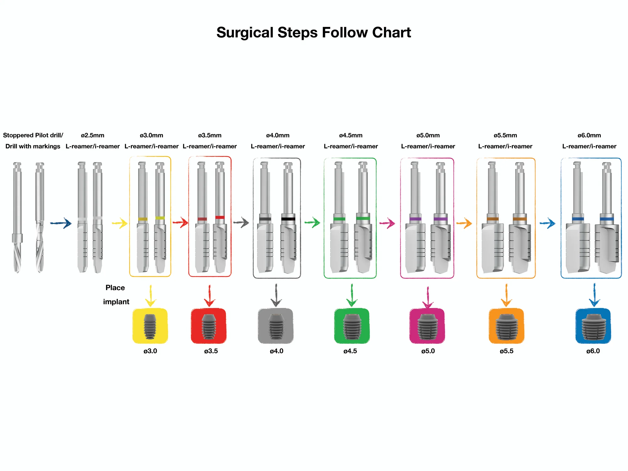 i-System surgical drilling protocol chart: nine drilling stages from the pilot drill to Ø6.0 mm, each with its reamer pair and colour-coded implant